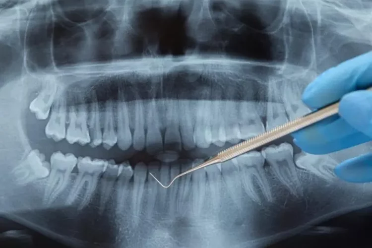 Zahnärztliche Chirurgie